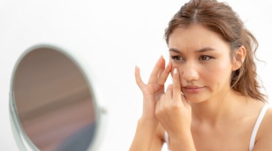 Woman worried about her skin